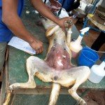 CNVR Procedure in Bangalore