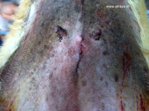 CNVR surgery Bangalore